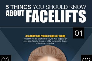 5 Things You Should Know about Facelifts [Infographic]