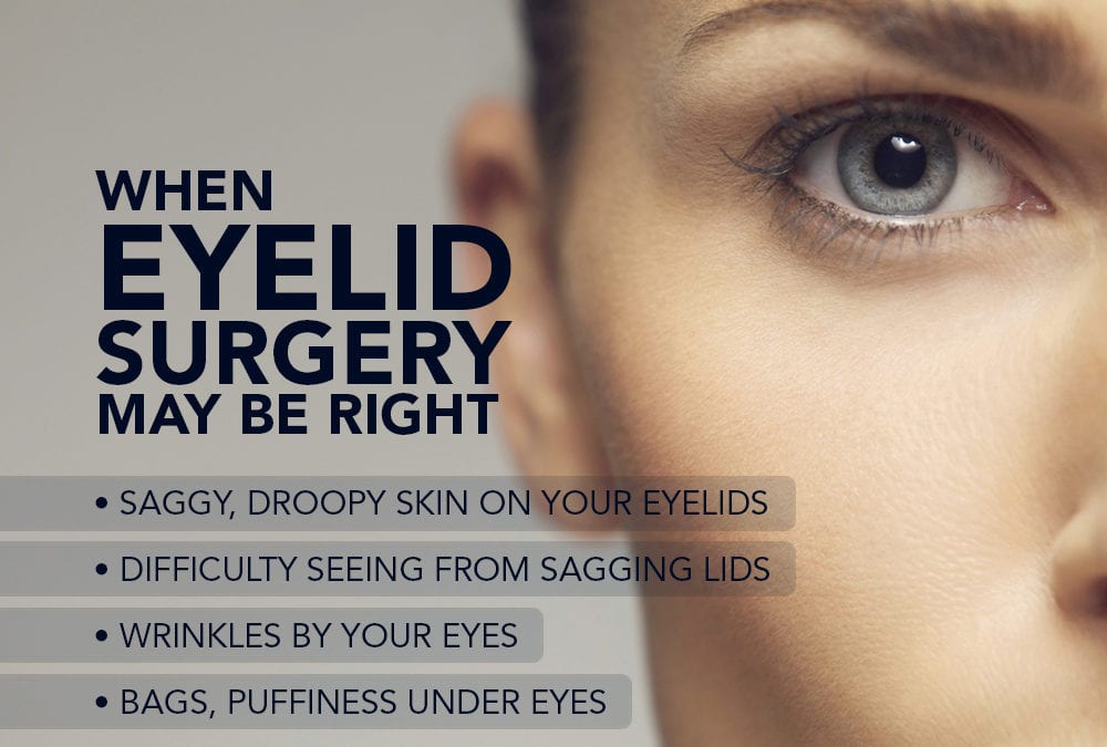 When Eyelid Surgery May Be Right [Infographic]