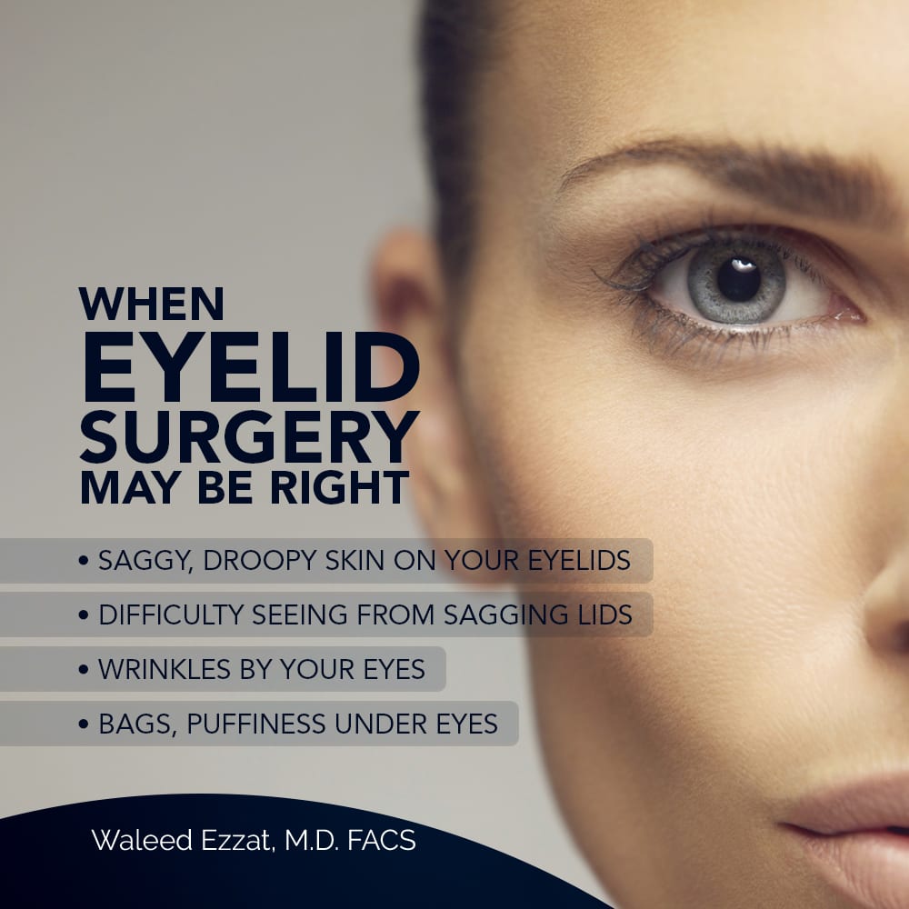 When Eyelid Surgery May Be Right [Infographic]