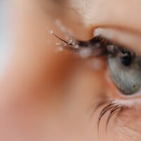 Your Surgical and Non-Surgical Options for Treating Tired Eyes