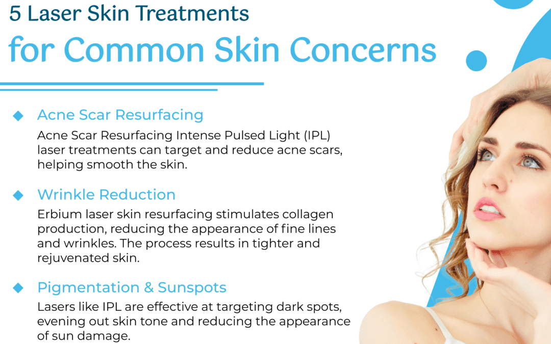 5 Laser Skin Treatments for Common Skin Concerns [Infographic]